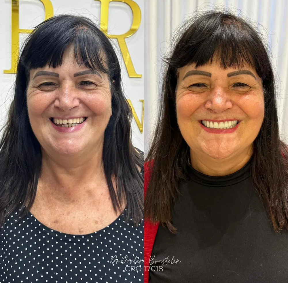Paciente sorrindo após o tratamento na Nobre Oral Clinic