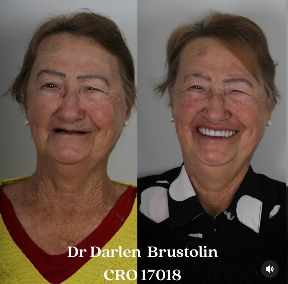 Paciente da Nobre Oral Clinic com o sorriso recuperado