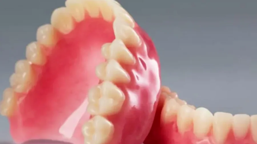 Dentadura tradicional removível